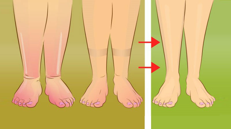 Gambe gonfie? Ecco cosa fare per stare meglio