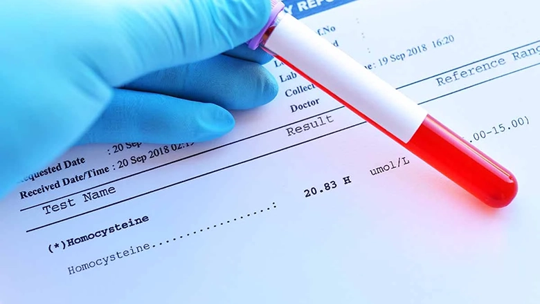 esame del sangue rivela una cosa inquietante