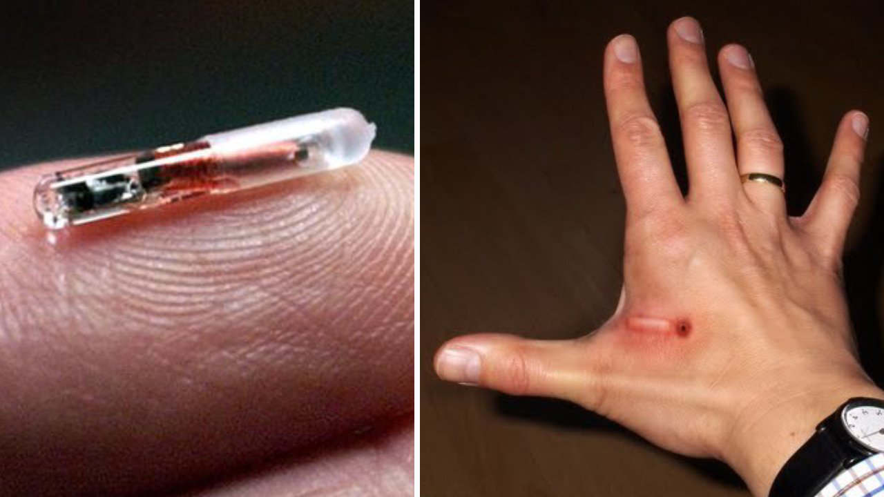 microchip