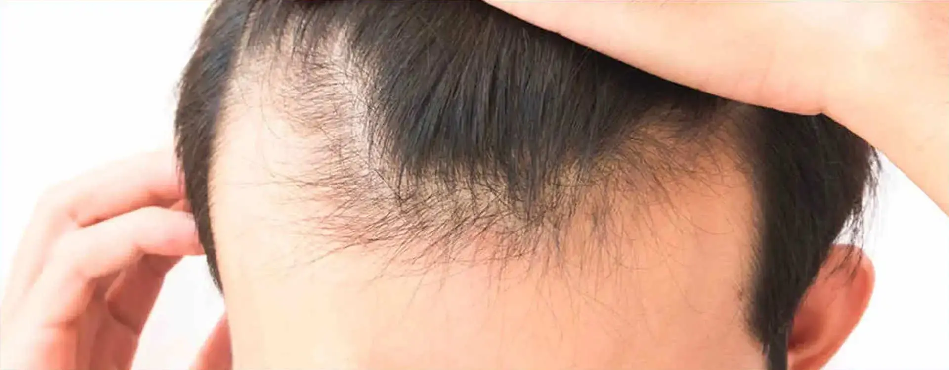 capelli